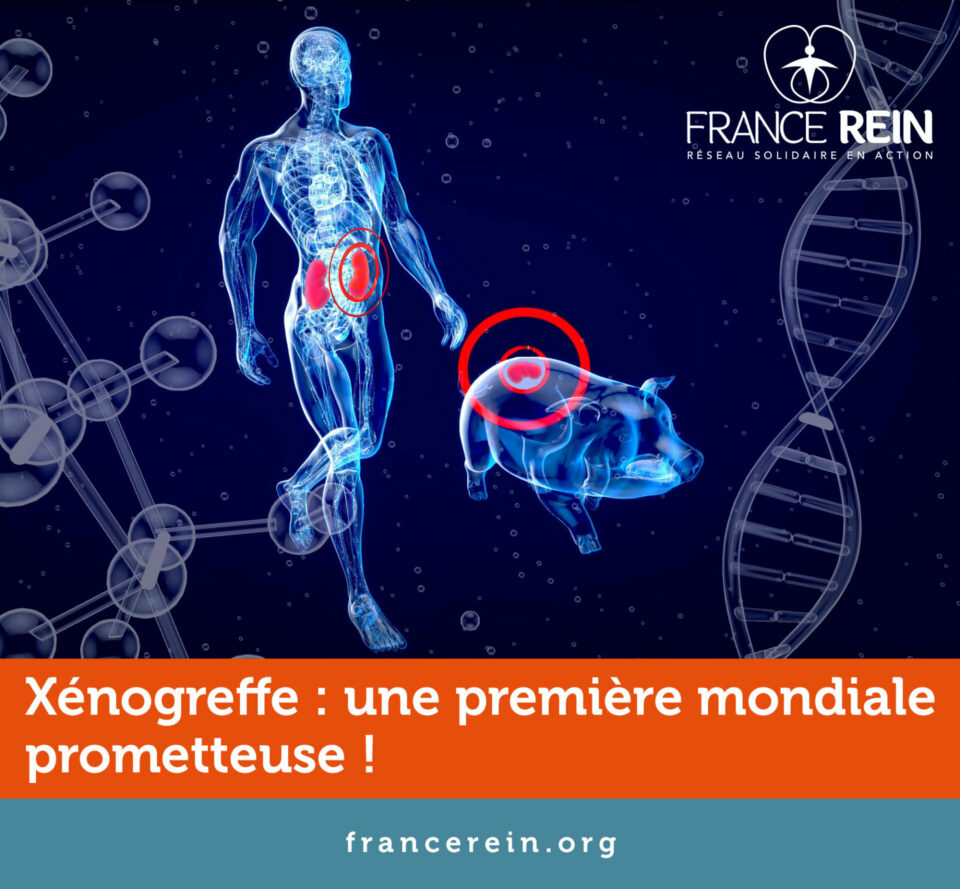 Xénogreffe : Une première mondiale prometteuse !