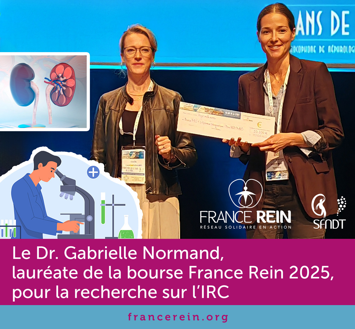 Le Dr Gabrielle Normand, lauréate de la bourse France Rein 2025, pour la recherche sur l'IRC